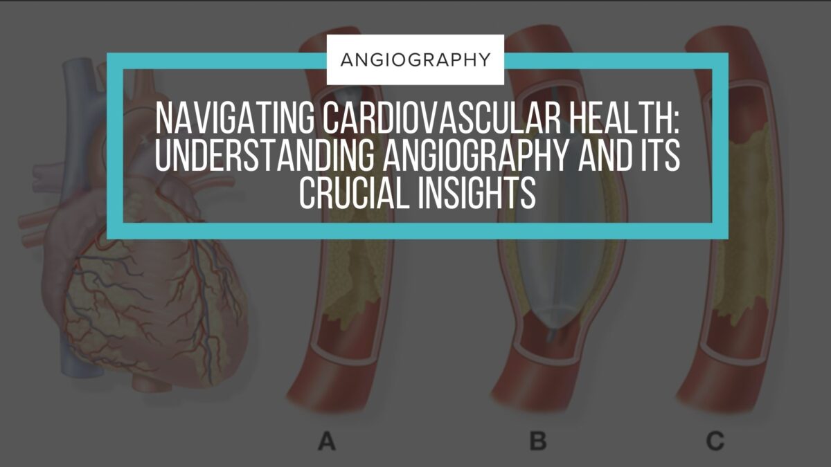 Cardiovascular health is angiography