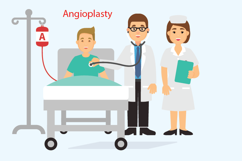 Angioplasty Surgeon in Jaipur